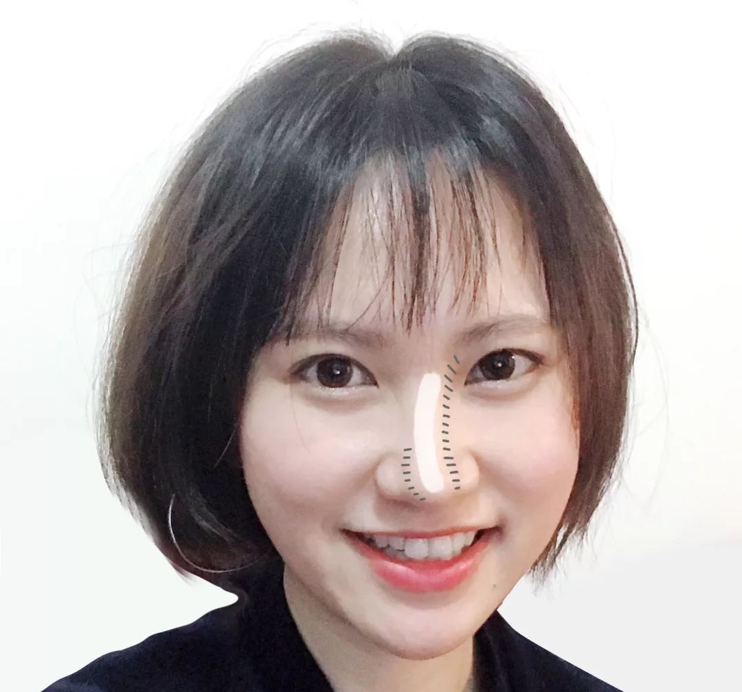 6种整容级鼻型修容法,6种鼻型矫正画法