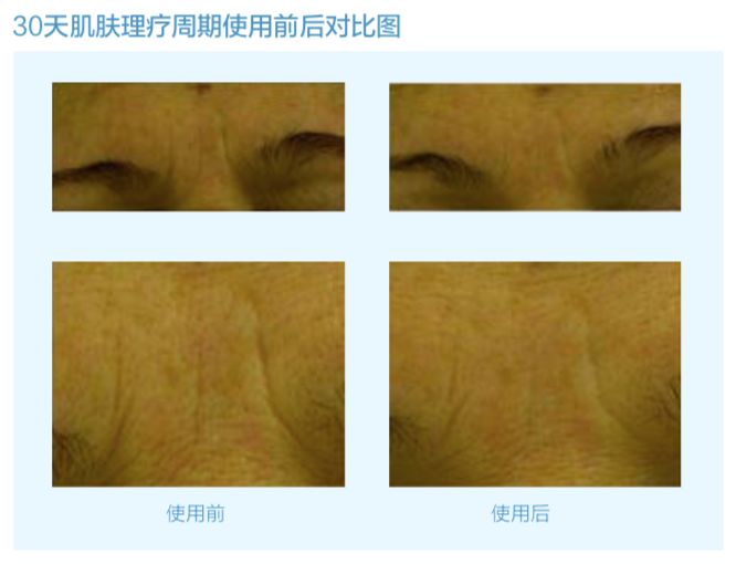 正品抗皱纹玻尿酸原液,vishya和赫梦娜玻尿酸哪个好