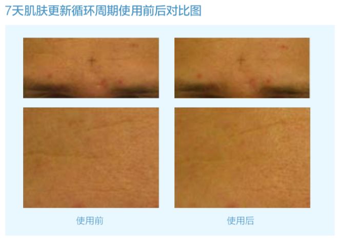 德国balea玻尿酸原液,德国玻尿酸dermaroller安瓶原液