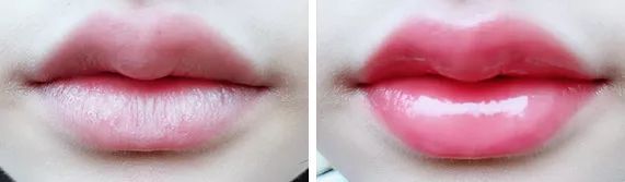 丰唇怎样让唇边更立体,适合丰唇的唇形