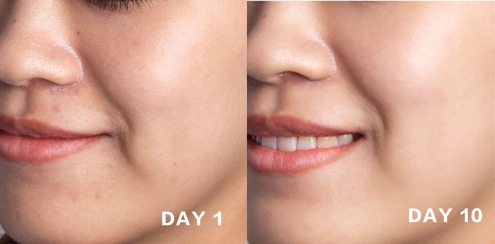 张韶涵推荐国货之光,张韶涵推荐的懒人用的精华