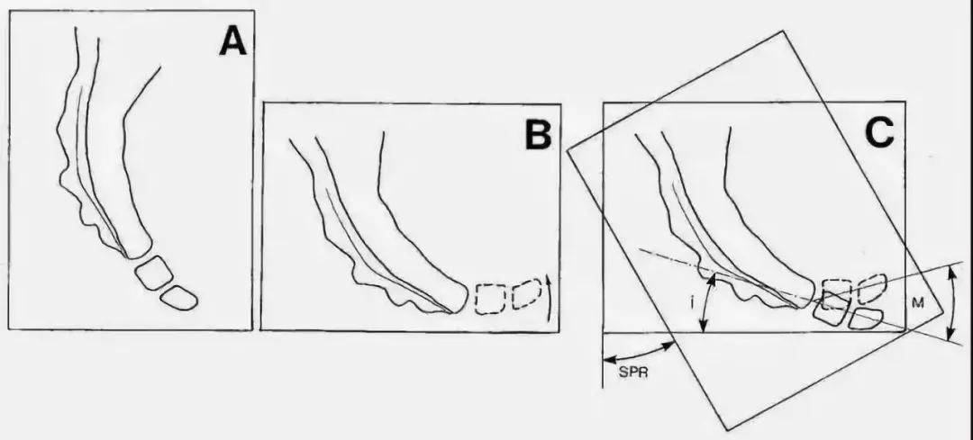 一文读懂十种腹痛,一文读懂骨关节炎