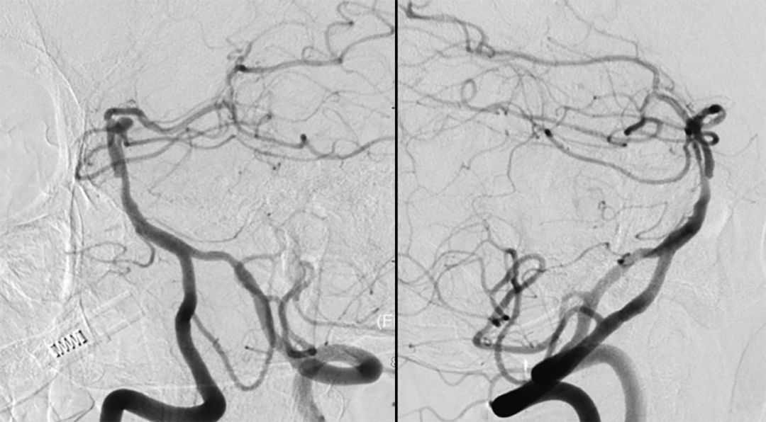 穆如清风的完结作品,穆如清风最新视频