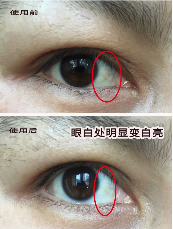 适合熬夜的护眼神器,眼睛疲劳用什么护眼神器