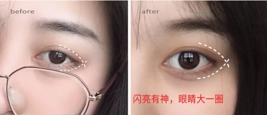 适合熬夜的护眼神器,眼睛疲劳用什么护眼神器