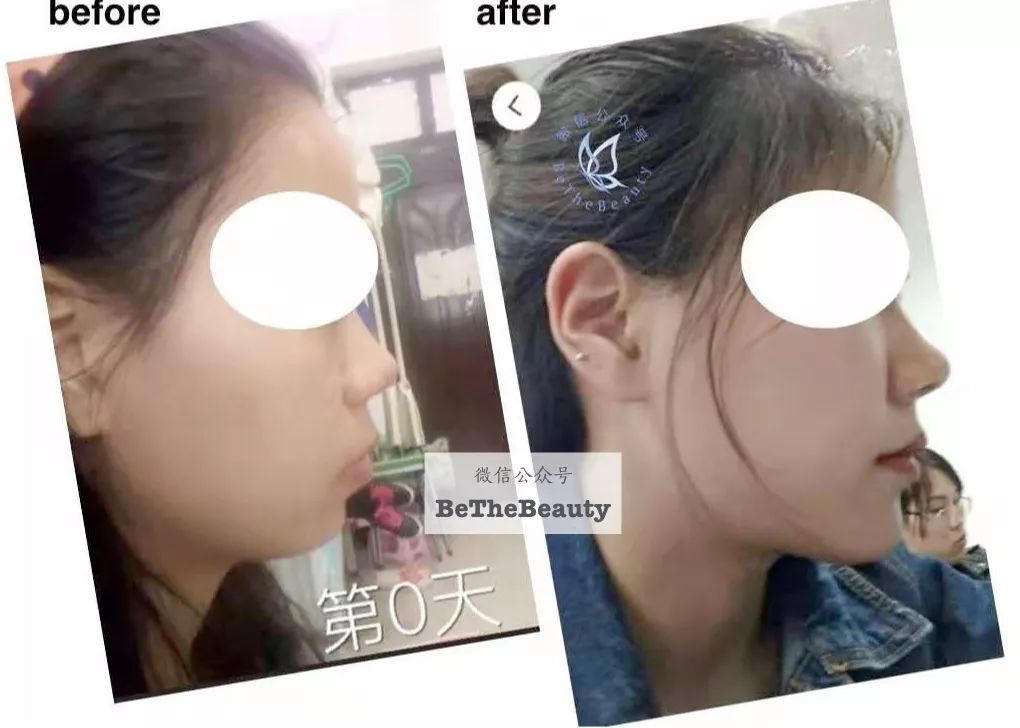 大学才是最好的整容院,为什么都说大学是整容院