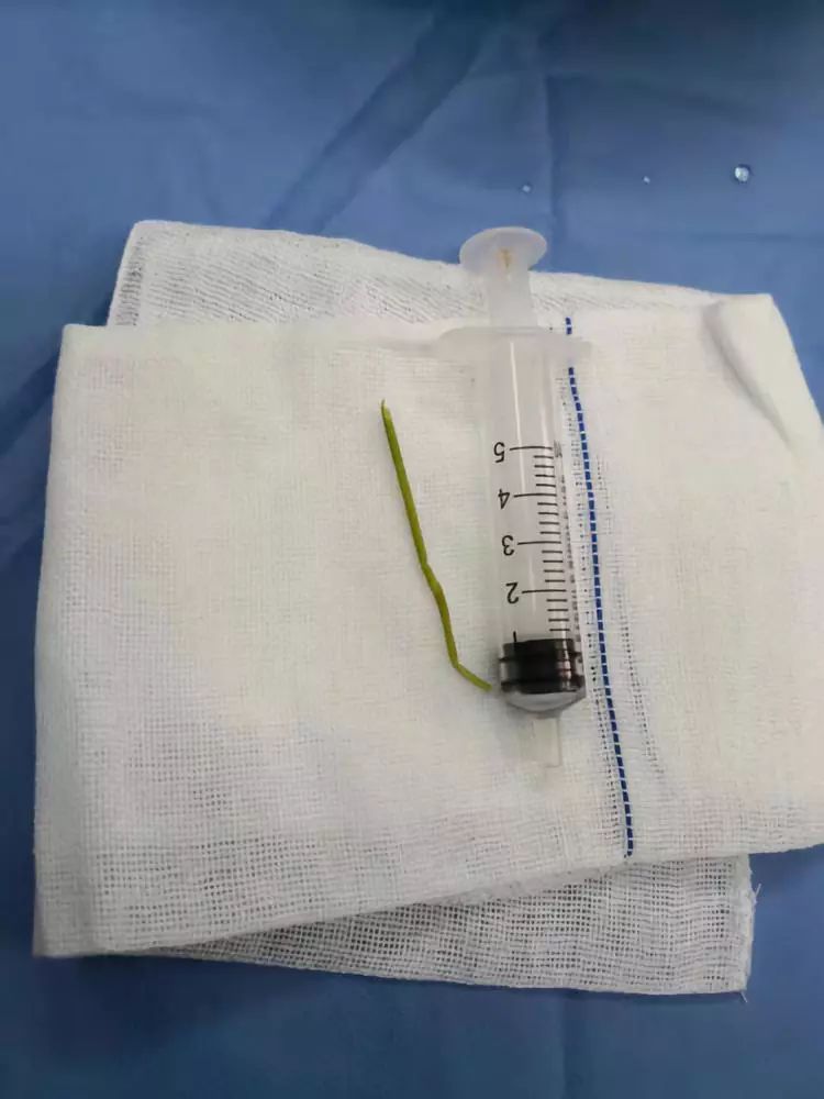 11岁男孩觉得要害部位不适，竟取出一根草
