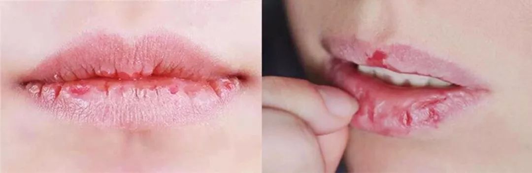 麻范儿好物|10秒卖出4万瓶！明星网红纷纷推荐，没有它，涂再好的口红也没用