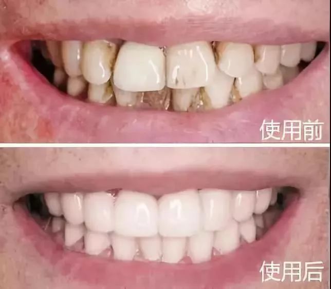 俄罗斯牙膏去黄牙怎么样,祛牙垢黄牙的牙膏国货之光