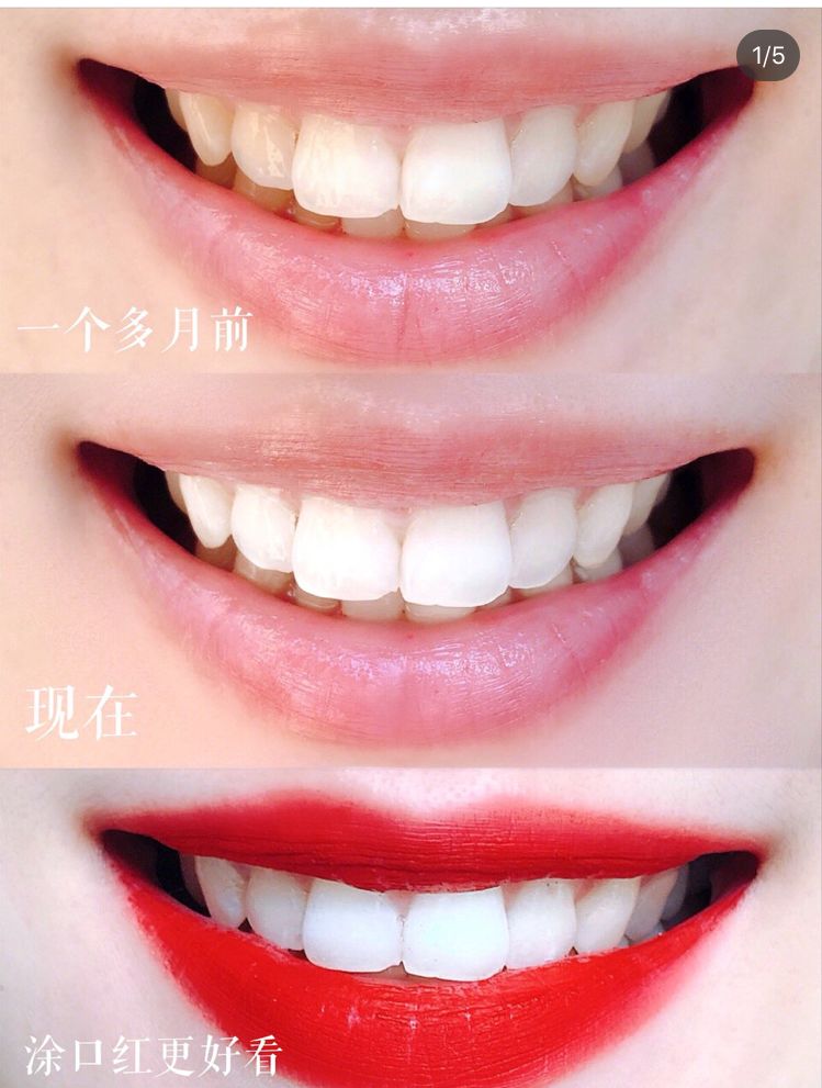 俄罗斯牙膏去黄牙怎么样,祛牙垢黄牙的牙膏国货之光