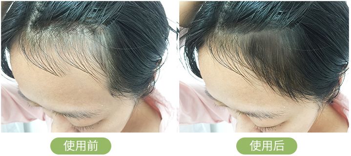 一根头发值25块,一根头发价值多少钱