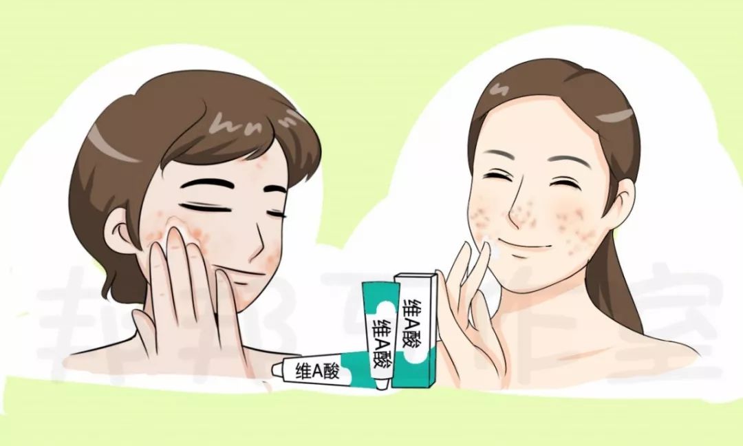 治痘痘维a酸最多用多久,治疗痘痘的维a酸类药品