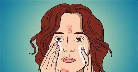 治痘痘维a酸最多用多久,治疗痘痘的维a酸类药品