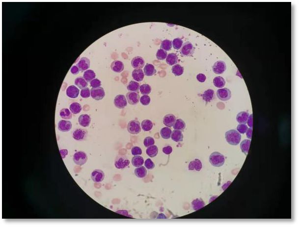 捐献干细胞详细过程感谢信,造血干细胞移植合集