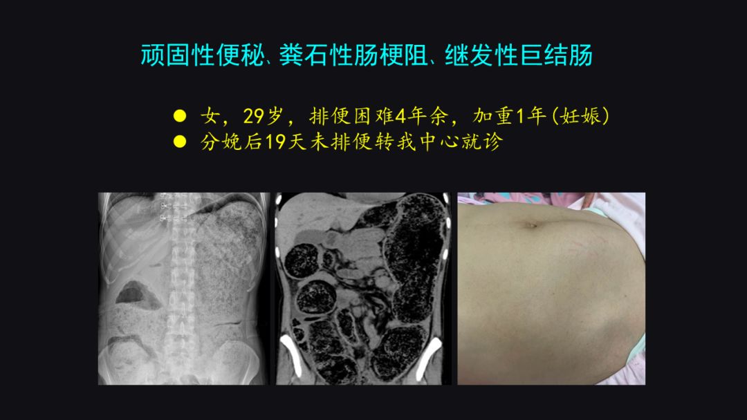 李宁奋斗历程英文版,李宁夜以继日