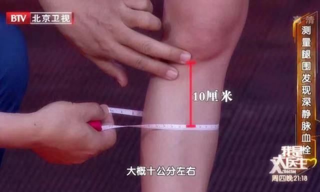 出现这4个征兆可能是血管堵住了,三根血管严重堵塞危险吗