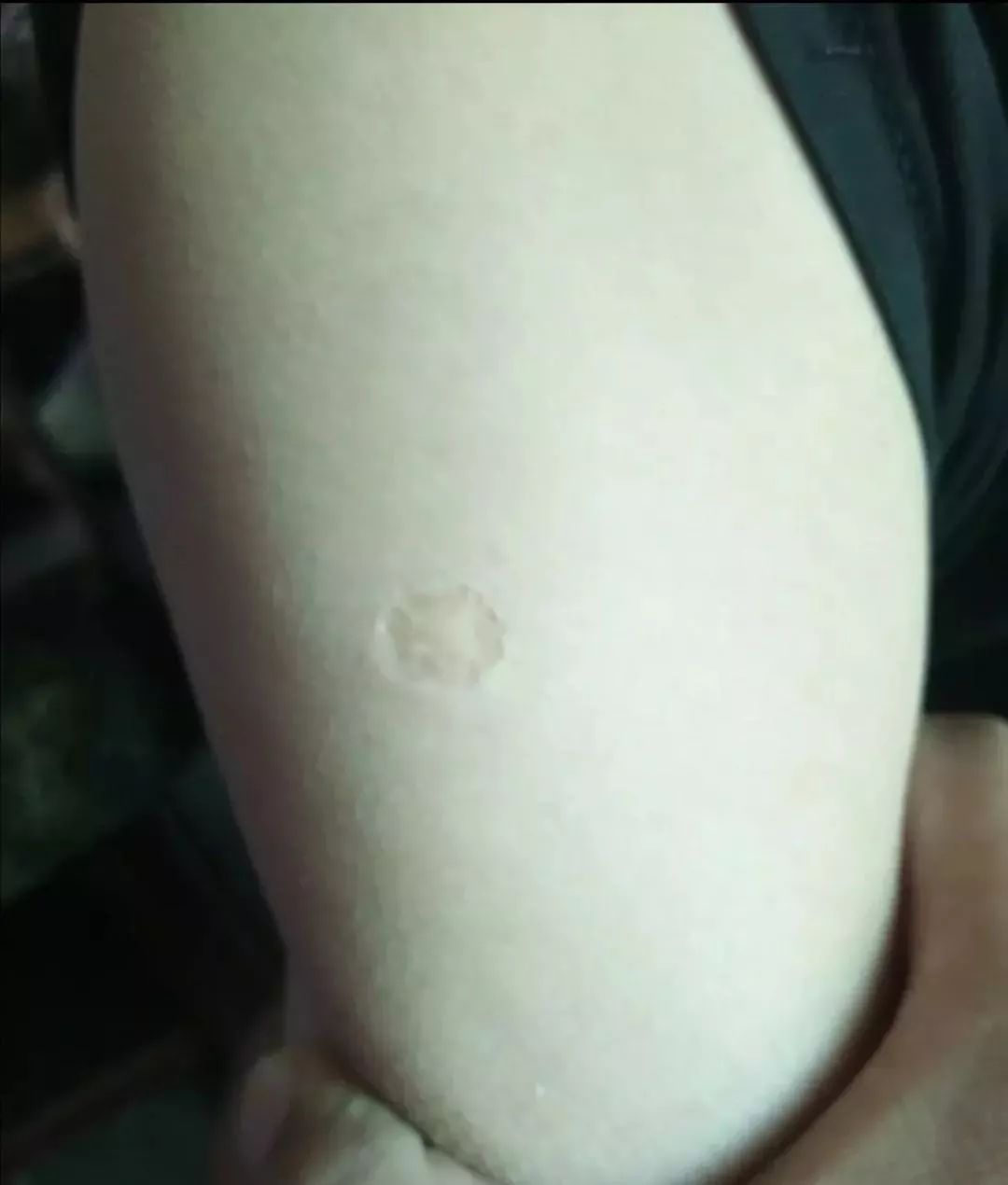 这个是啥？我父母、爷爷都有，为啥我没有？