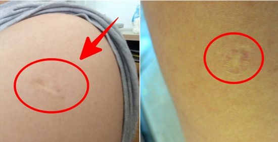 这个是啥？我父母、爷爷都有，为啥我没有？