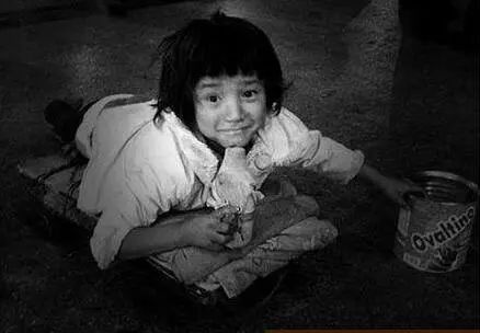 眼球被挖的人后续,眼球被挖了还能修复吗