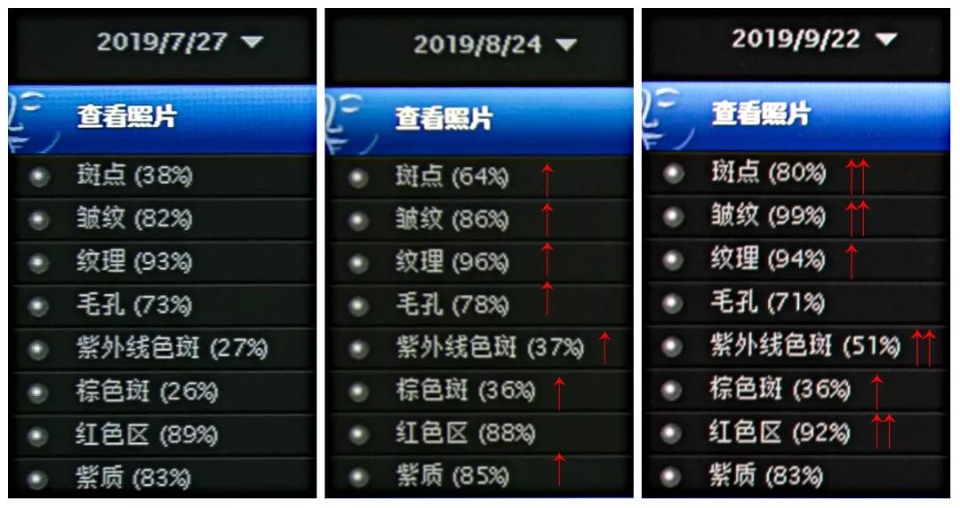 肌诊室修复,肌诊室水光肌挑战