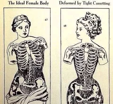 400年前就该消失的瘦身垃圾，因为网红一吹，居然又火了