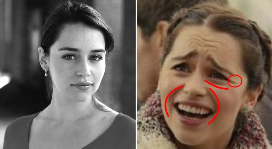 法令纹眼纹一个都逃不掉,法令纹和眼纹怎么才能有效改善