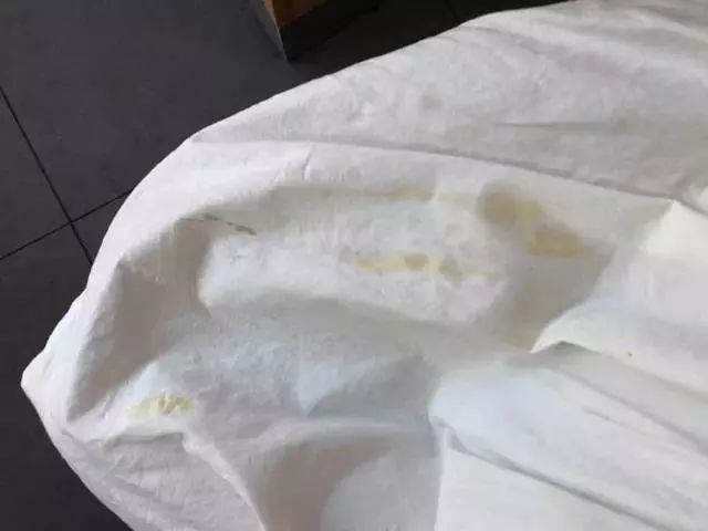 换季的衣服发霉怎么办,白色衣服长霉斑用什么可以除掉