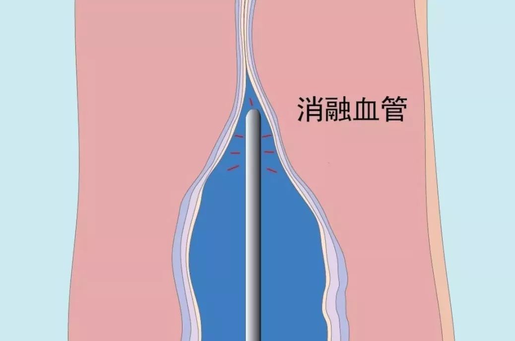 不得不防!大多数中老年人都有这个毛病生活中这些习惯要改掉......