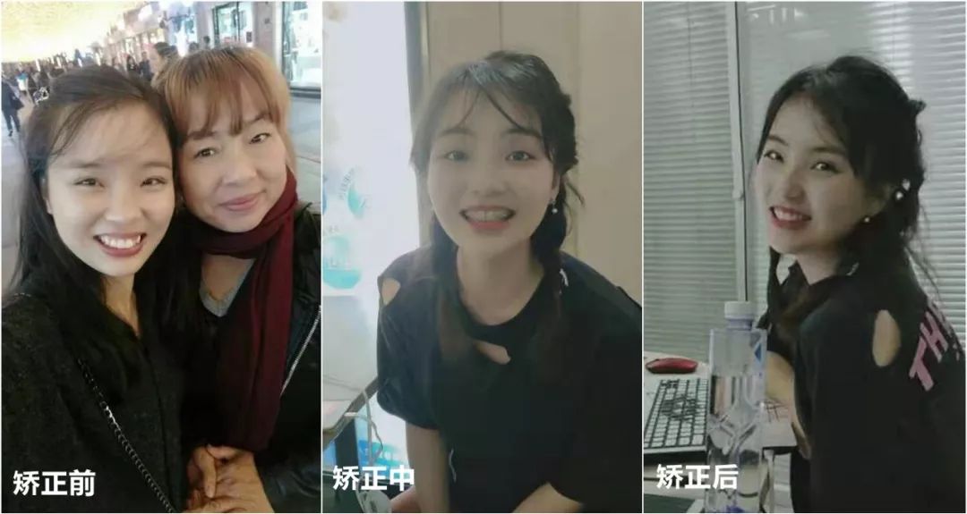 最短只要一年，这件事做对了堪比整容