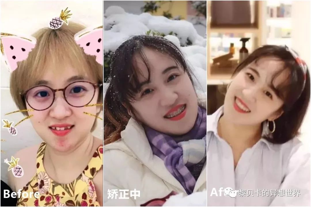 最短只要一年，这件事做对了堪比整容