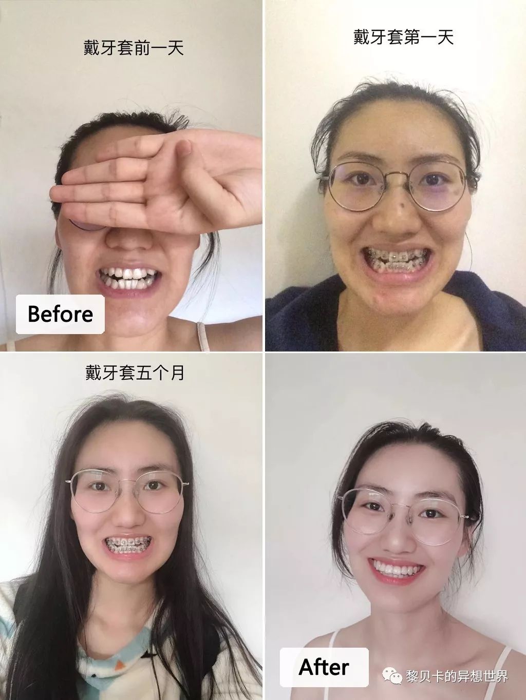 最短只要一年，这件事做对了堪比整容