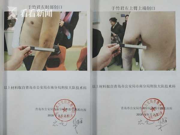 青岛枪击事件,青岛市枪击事件