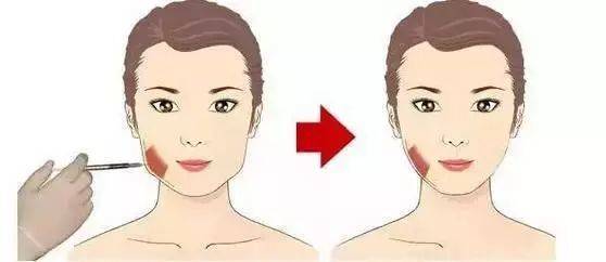 十大骗局肉毒素药,微整形注射假药案例