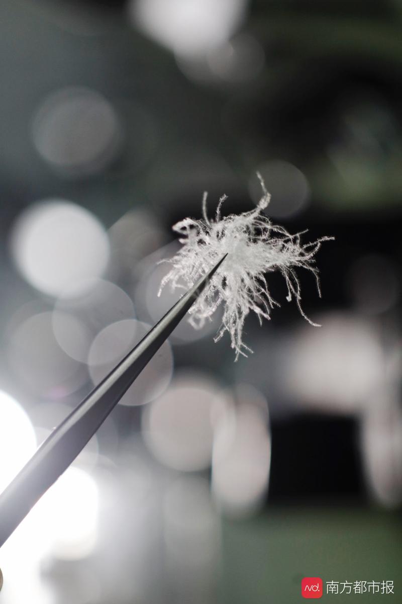 羽绒服质量不过关会导致过敏,诱发过敏