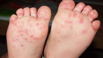 悦暖臻心融享健康|融创太原健康大讲堂首场讲座特邀儿科专家暖心开讲