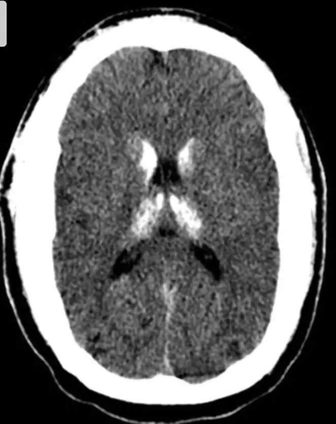神经影像,神经影像解剖图