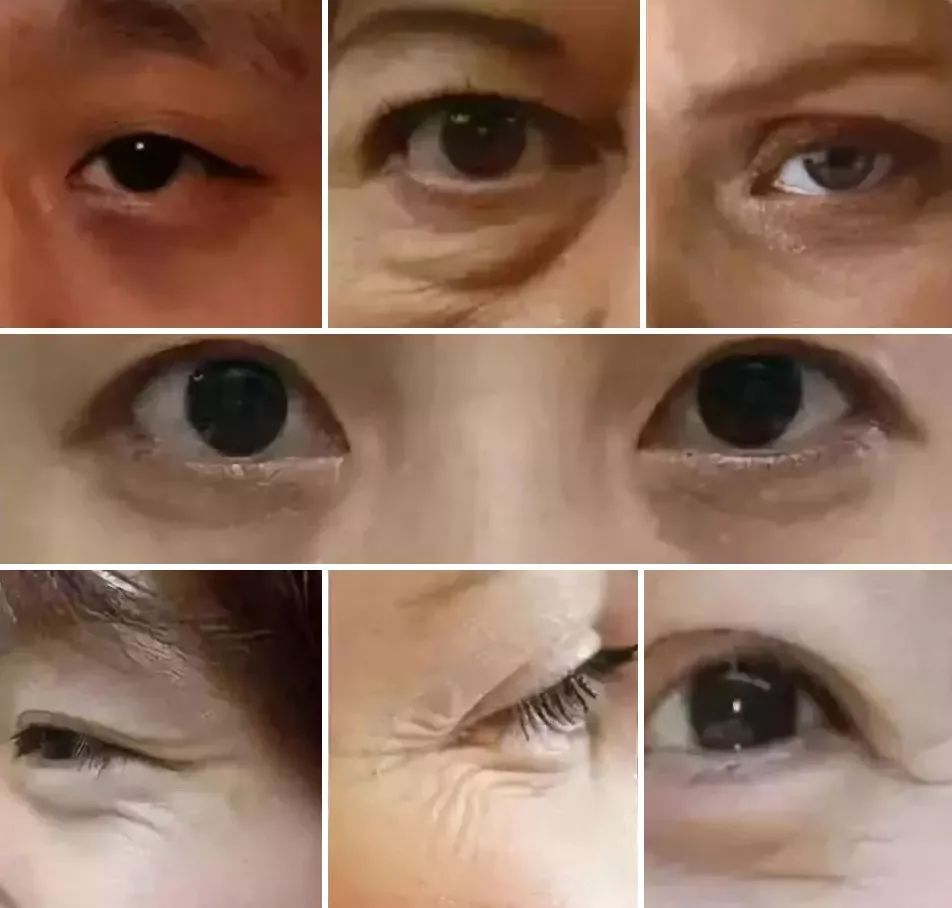 眼部周围除皱霜,眼部抗皱紧致面霜