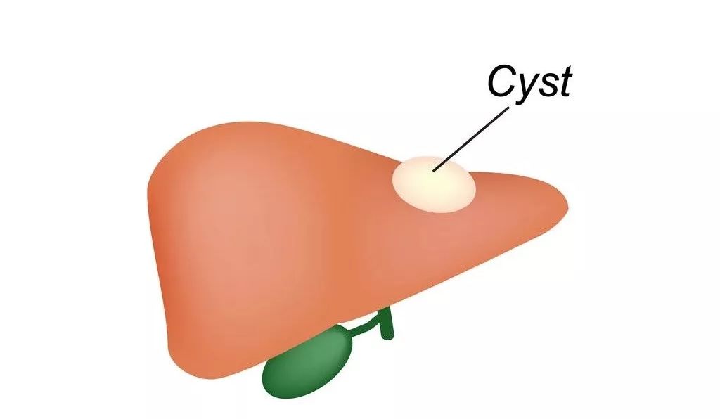 结节囊肿增生息肉形成原因是什么,内膜息肉增生怎么治