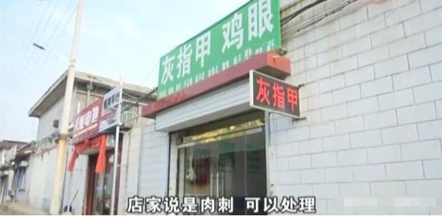 女子脚上拔出黑刺,女子脚底被一根刺扎伤了