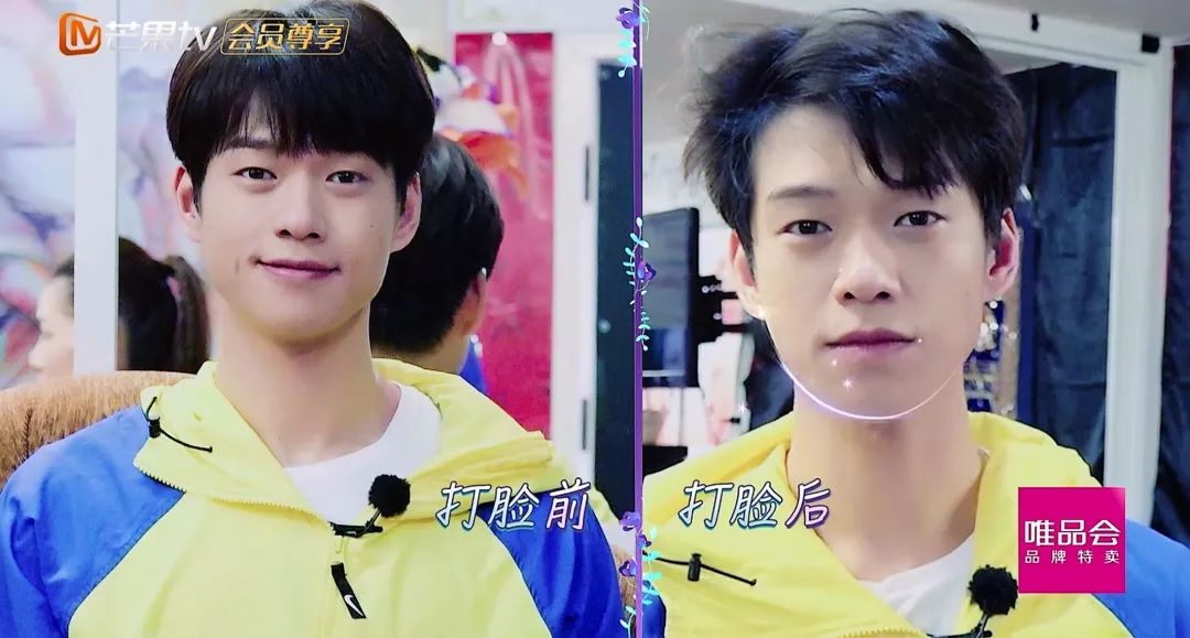 泰国打脸法瘦脸,泰国打脸术真的能瘦脸