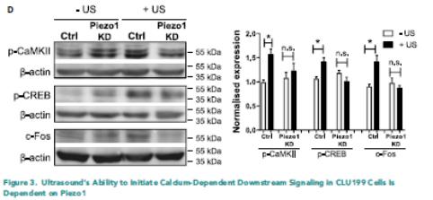 超声神经调控2020,超声神经调控视频