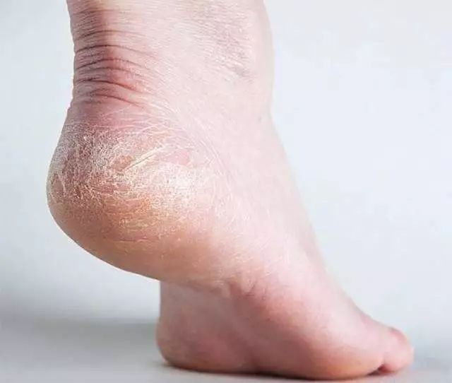 手部护理保养精油,spa护理手套