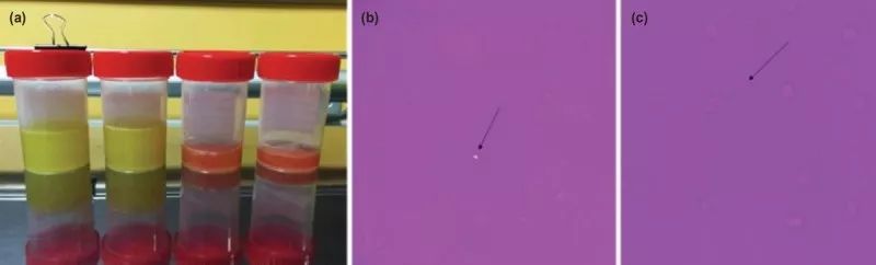同一部位痛风是什么原因,痛风同个地方反复发作