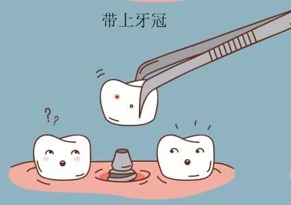 种牙后期会不会很麻烦,第一种牙真的很可怕吗