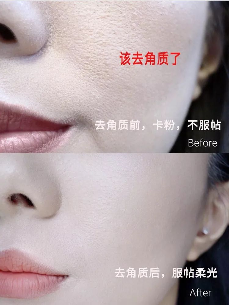 柔嫩抛光|脸上搓出3斤泥!难怪又黄又暗又黑头!10秒给脸蛋“剥壳”,厉害