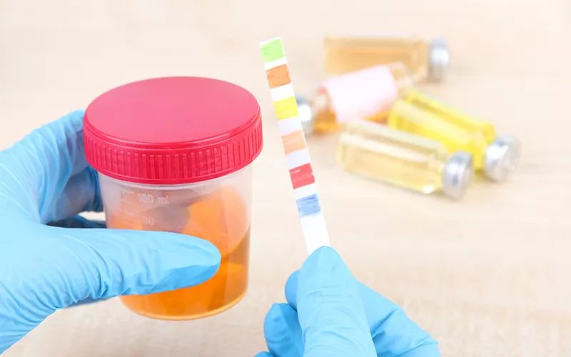 尿常规检查尿糖（+）就是糖尿病吗？