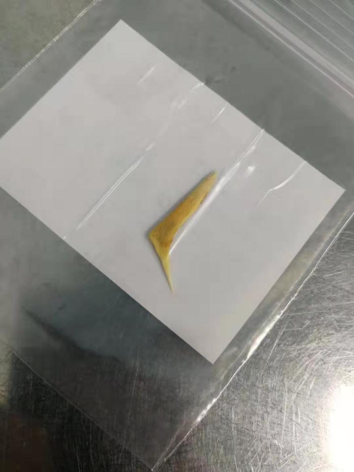 吃甲鱼肚子疼有什么危害,吃甲鱼肚子疼是中毒了吗