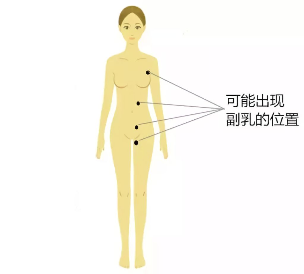 医生也会得乳腺疾病吗,副乳切除手术会不会得乳腺癌