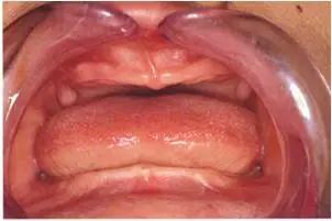 牙齿离奇失踪,牙齿诡异事件