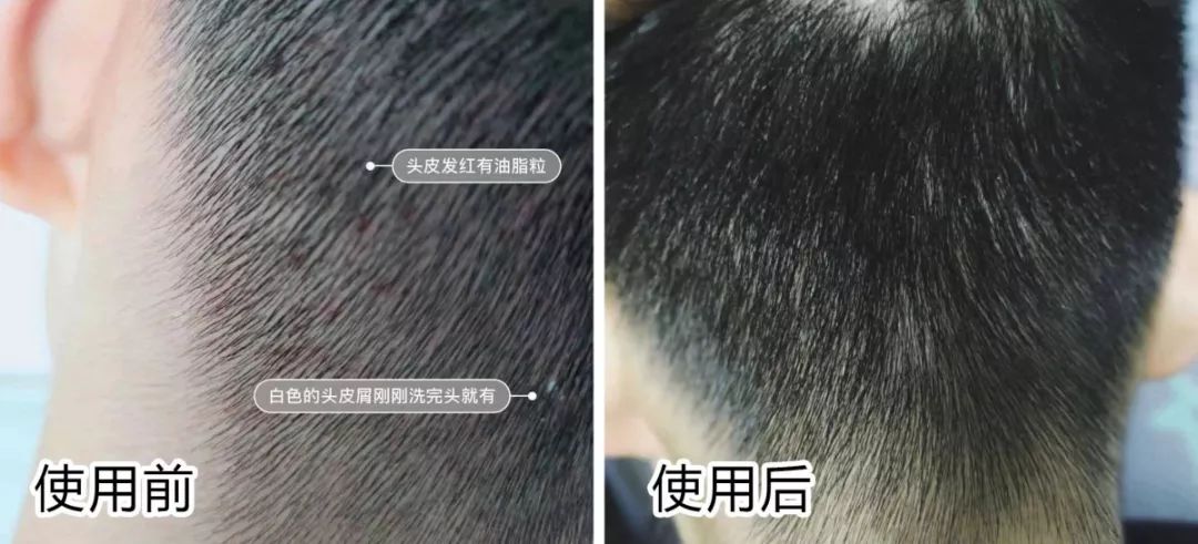 床上放个它，让螨虫绝望，让螨虫自杀，比太阳暴晒强1万倍